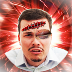 Prellung Augen komisch Foto