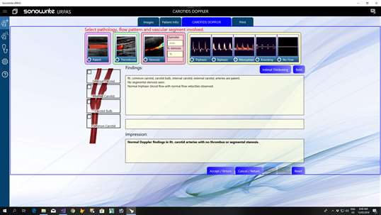 SonoWrite Ultimate screenshot 1