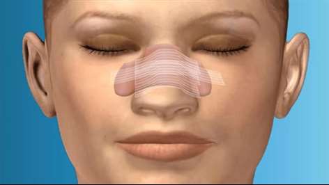 Virtual Nose Surgery Screenshots 2