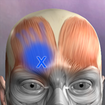 Muscle Trigger Points