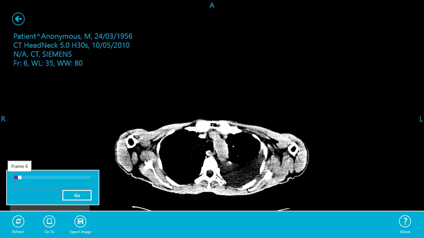 Quick browse and export your medical images.