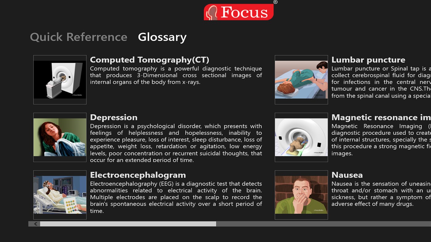 #5. Migraine - Animated Quick Reference (Windows) Által: Focus Medica India Pvt Ltd