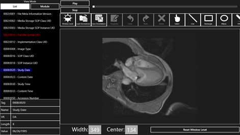 LEADTOOLS DICOM Viewer Screenshots 2