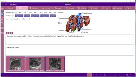 SonoWrite Screenshots 1