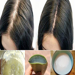 Hair loss treatments