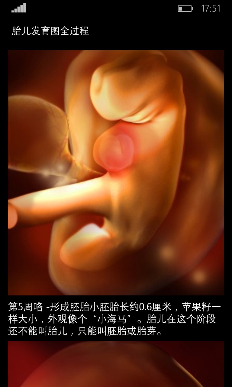 Эмбрион 5 недель выкидыш