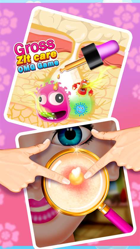 OMG Gross Zit Care Beauty Salon Deluxe - Pimple Popper Screenshots 2