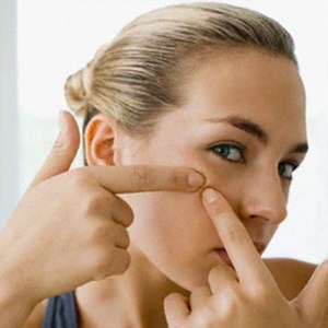 Homemade remedies to treat pimples