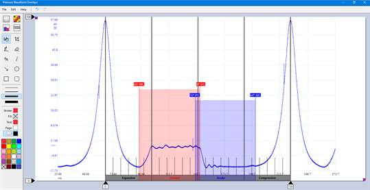 Pressure Waveform Overlays screenshot 1
