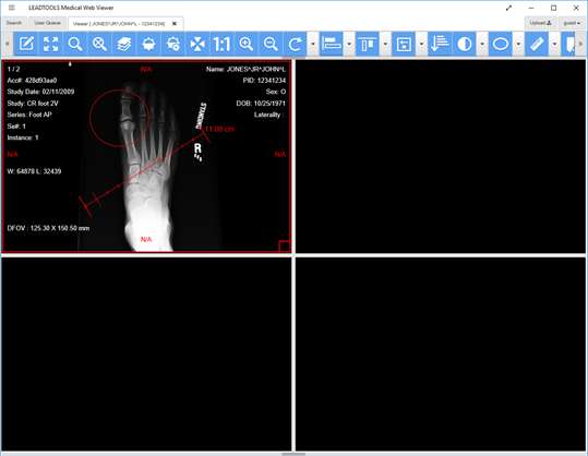 LEADTOOLS Medical Web Viewer screenshot 3