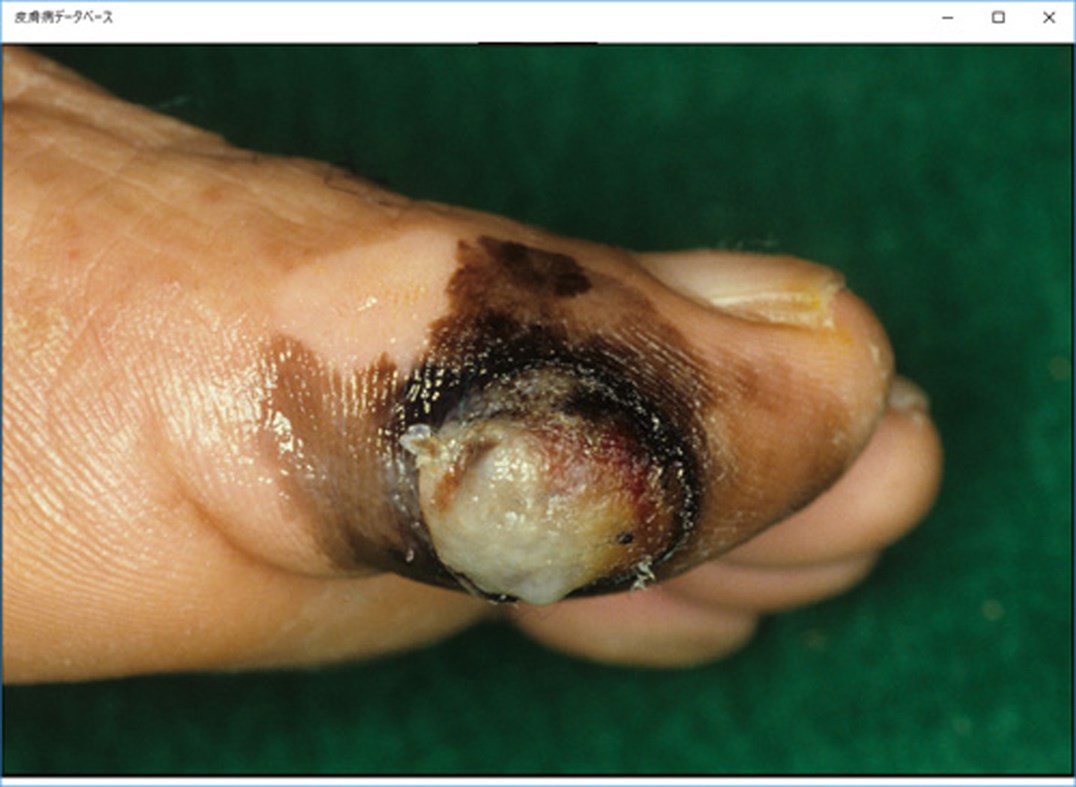 #4. YSP Dermatology Image Database (Windows) 게시자: Yasusi Suzumura