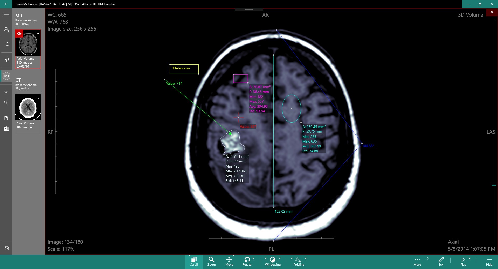 TIMS Medical DICOM System (061000-2000-SP) WIN10