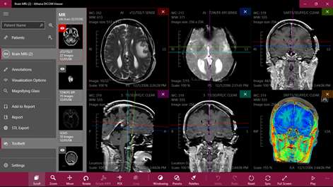 Athena DICOM Viewer Screenshots 1