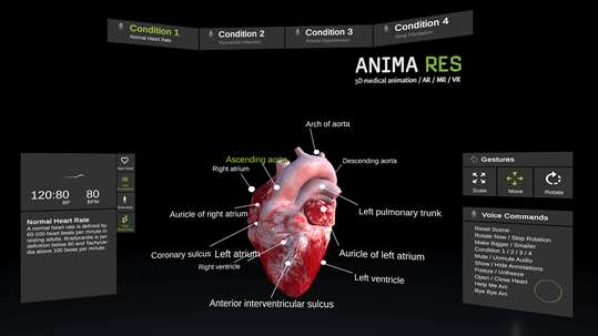 INSIGHT HEART VR screenshot 5