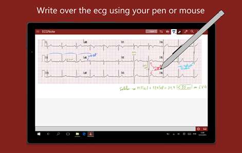 ECGNote Screenshots 1