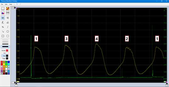 Pressure Waveform Overlays screenshot 2
