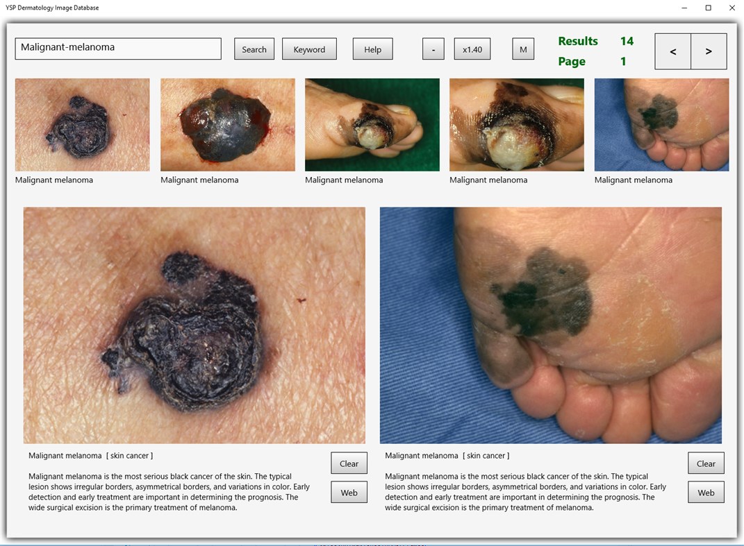 #1. YSP Dermatology Image Database (Windows) 게시자: Yasusi Suzumura
