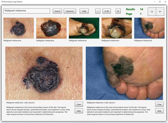 YSP Dermatology Image Database screenshot 1