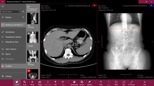 Athena DICOM Viewer screenshot 9