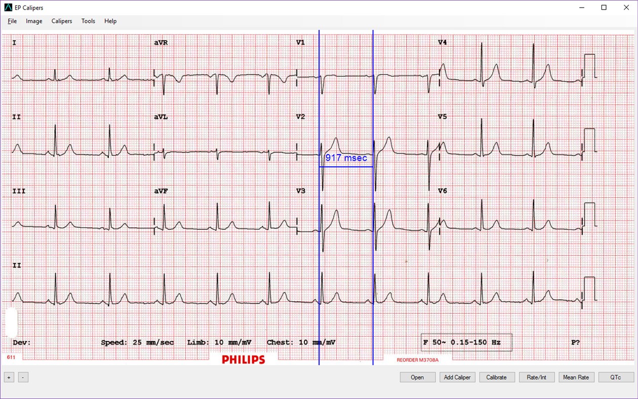 #1. EP Calipers (Windows) 由: EP Studios