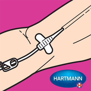 Quel set pour quelle perfusion ?