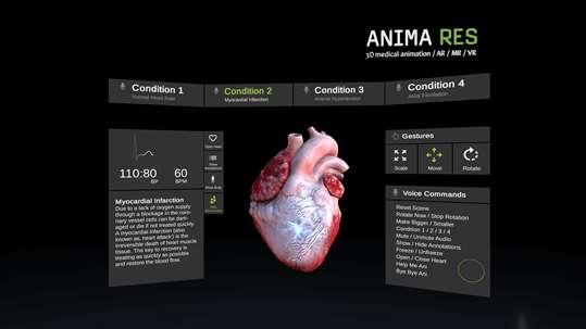 INSIGHT HEART VR screenshot 2