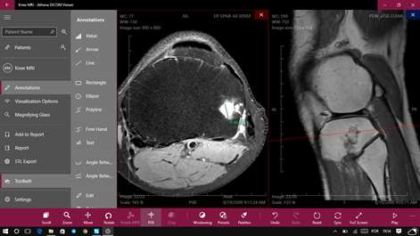 Athena DICOM Viewer Screenshots 2