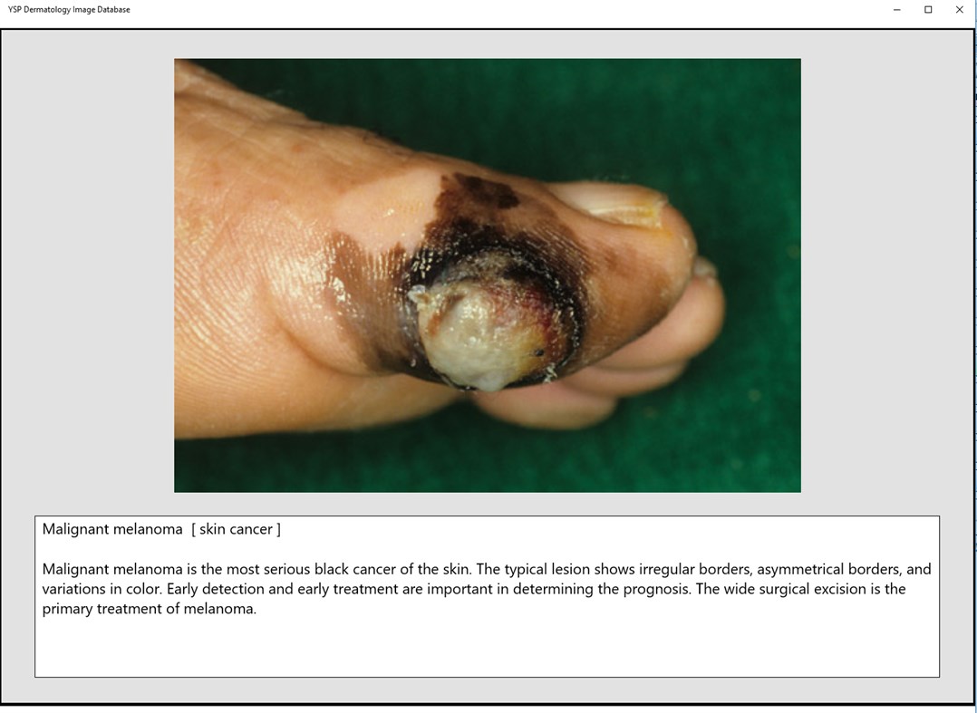 #3. YSP Dermatology Image Database (Windows) 게시자: Yasusi Suzumura