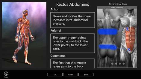 Muscle Trigger Points Screenshots 1