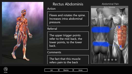 Muscle Trigger Points screenshot 1
