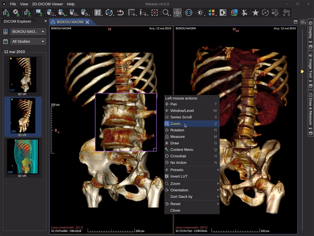 Dicom web viewer. Dicom. Dicom viewer. Veasis Dicom. Архимед Dicom viewer.