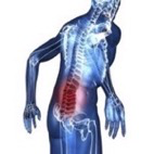 Sciatic Pain Relief