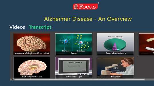 Alzheimer’s disease - An Overview screenshot 1