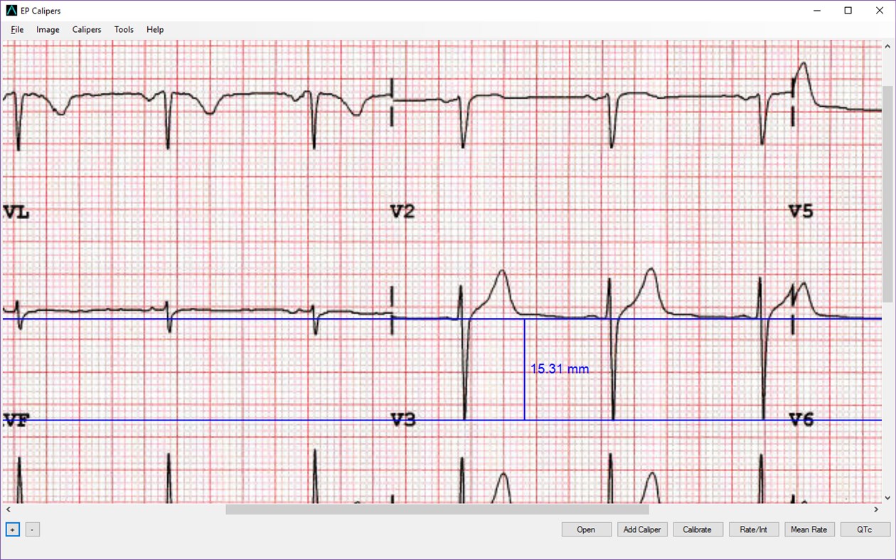 #4. EP Calipers (Windows) 由: EP Studios