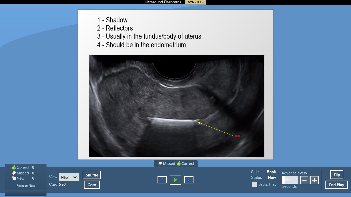 Buy ARDMS OBGYN + Abdomen Ultrasound Flashcards For ARDMS OB/GYN ...