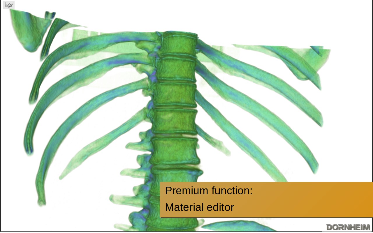 【图】Dornheim 3D DICOM Viewer(截图3)