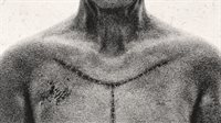 Autopsy Simulator