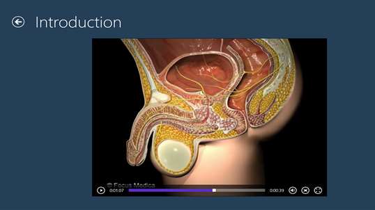 Benign Prostatic Hyperplasia (BPH) - An Overview screenshot 2