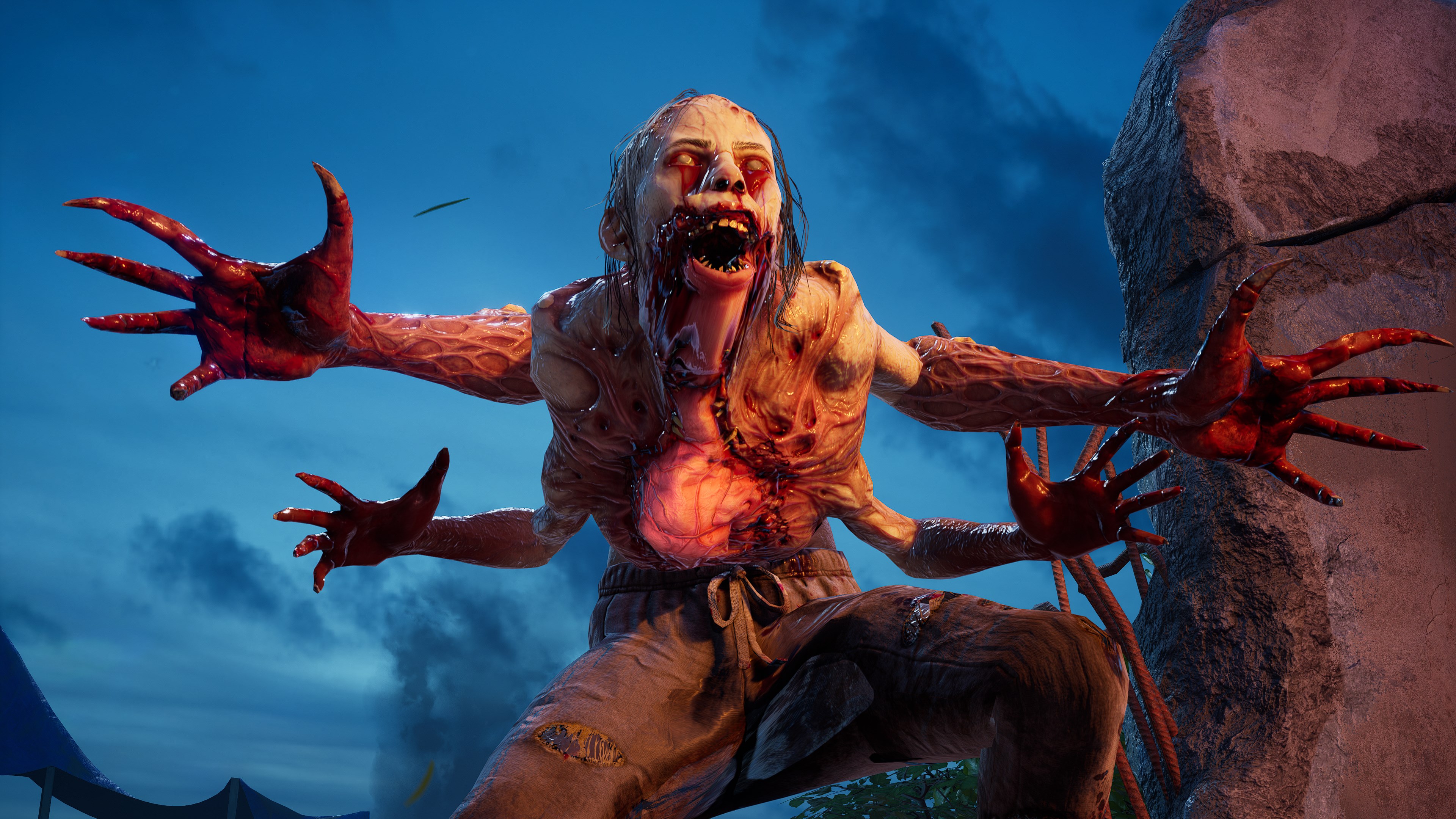Back 4 Blood: Ultimate Edition | Xbox | Chiave | Privato
