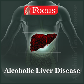 Alcoholic Liver Disease - An Overview