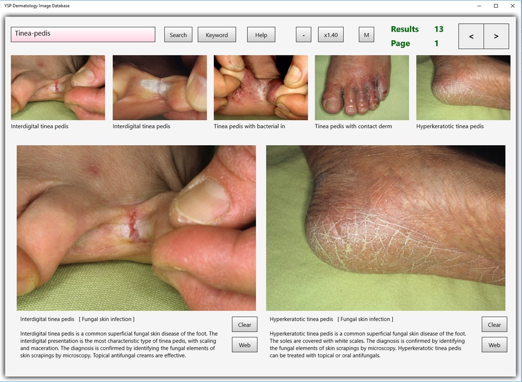#5. YSP Dermatology Image Database (Windows) 게시자: Yasusi Suzumura
